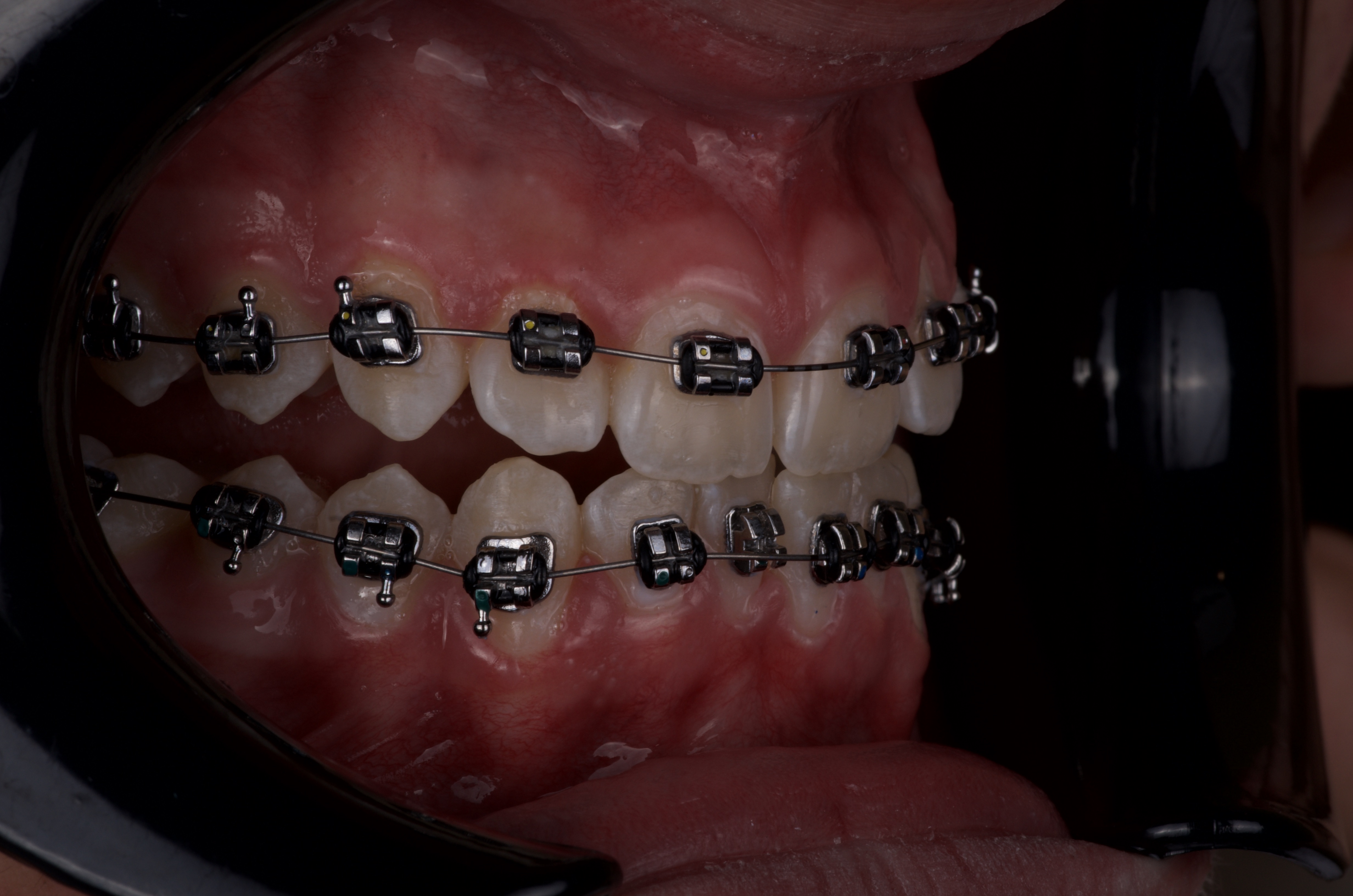 Ortodoncia 0